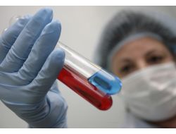 Yeni HIV aşısı başarılı oldu!