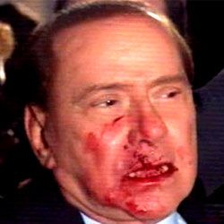 Berlusconi'ye  Yumruklu Saldırı