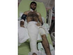 Trafik Kazasında Kopan Bacak Iğdır Devlet Hastanesi'nde Yerine Dikildi