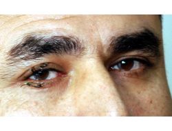 Elbistan'da Görmeyen Göz Hamile Bir Bayandan Alınan Kordon Zarıyla Açıldı