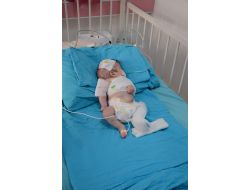 Annesi Tarafından Darp Edilen Bebeğin Tedavisi Sürüyor