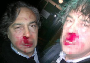 BARBAROS ŞANSAL'I DÖVDÜLER