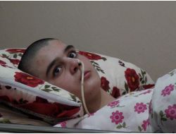 Sivas’ta Kalan Afganlı Çocuk Kaza Sonrası Yatağa Mahkûm Oldu