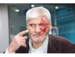 Maganda Kurşunu İle Hayatı Karardı, Yüz Nakli İçin Yardım Bekliyor