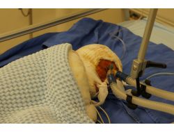 Esed'in Bombaladığı Suriyeliler Adana'da Şifa Arıyor