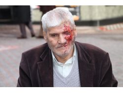 Yüz Nakli İsteyen Şadi Durmuş’ A Devlet Eli Uzanıyor