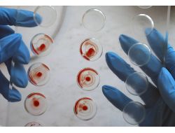 Rusya, Türkiye’den Öldürülen Çeçenlerin Dna Örneklerini Aldı