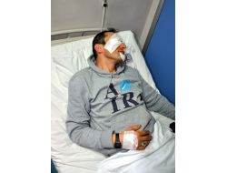 Beslediği Yabani Kurt Hastanelik Etti