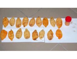 Kolombiyalı Papazın Midesinden 800 Gram Kokain Çıktı