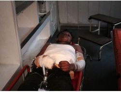 Patlamada Yaralanan Genç Yanık Tedavi Merkezine Götürüldü