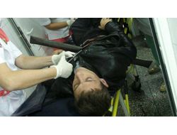 Vücuduna 2 Metre Demir Boru Giren Genç Hayatta