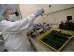 Rusya’da Domuz Gribinden Bir Kişi Hayatını Kaybetti