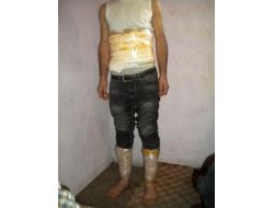 Vücuduna Sarılı 3 Bin 878 Gram Eroin Maddesi