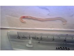 Eğirdir Gölü’ndeki Sudak Balığında Parazit Tespit Edildi