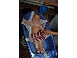 Bebekler En Fazla Mevsim Geçişlerinde Hasta Oluyor