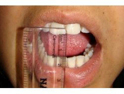 Stres, Kadınlarda Çeneyi Düşürüyor!