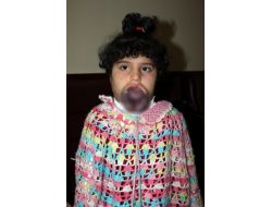 Suriye’den Geldi, Kayseri’de Şifa Arıyor!