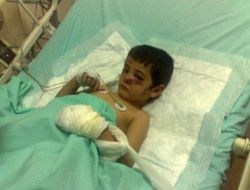 Topbaş: Sokak Çocuklarından Mendil Alınması Başka Çocukları Da Sokağa Çekiyor