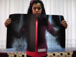 12 Yaşındaki Öğrenci 2 Aydır Midesindeki 1 Lira İle Yaşıyor