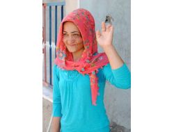 Bir Yaşında Yüzü Yanan Sakine Estetik Ameliyat İçin Yardım Bekliyor