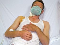 Diyalize Bağımlı Yaşamaktan Kurtuldu