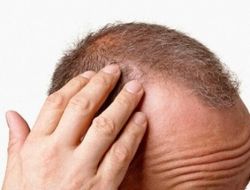 Troid Hastalıkları Önce Saçı Vuruyor