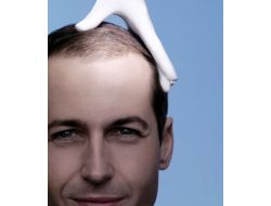 VİTAMİN EKSİKLİĞİ SAÇ DÖKÜYOR