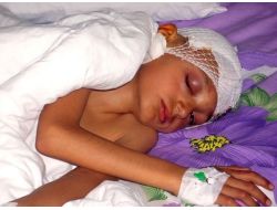 Parkın Yanına Koyulan Borulardan Düşen Çocuğa 30 Bin Lira Tazminat