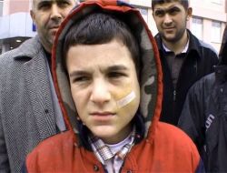 Maganda Kurşunuyla Yaralanan Küçük Turgut, Karne Sevincini Yaşayamadı