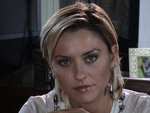 Ünlü oyuncunun gözleri çöktü!