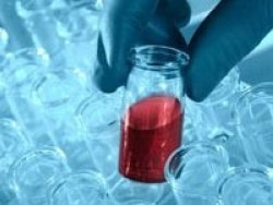 Kanser HIV'den kurtardı!