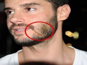 Olayı neden sakladığı belli oldu!