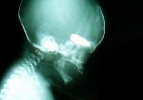 Kan Donduran Ölüm Oyunu