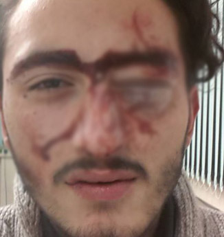 Alman polisi Türk gencini bu hale getirdi