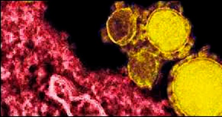 Hatay'da MERS paniği