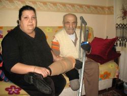 Bir Ayağını Sigaraya Verdi, Şimdi Dumanından Bile Kaçıyor
