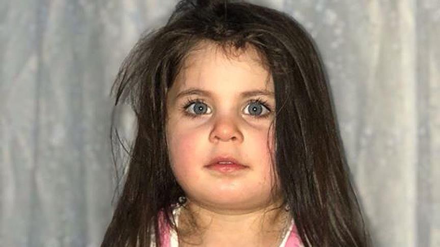 Ağrı Valisinden 'Leyla' açıklaması: 8-10 gün aç bırakıldığı için ölmüş