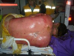 "Hayatını Kaybedenlerinin Sayısı 17 Değil, 13 Kişi"