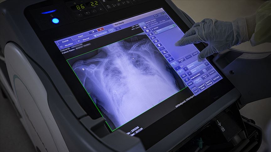 Türkiye'de son 24 saatte 1703 kişiye Kovid-19 tanısı konuldu!