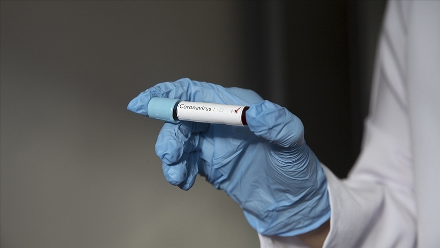 Gençlerbirliği'nde bir futbolcunun Kovid-19 testi pozitif çıktı!