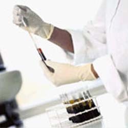 YOLSUZLUĞA BÜYÜK DARBE