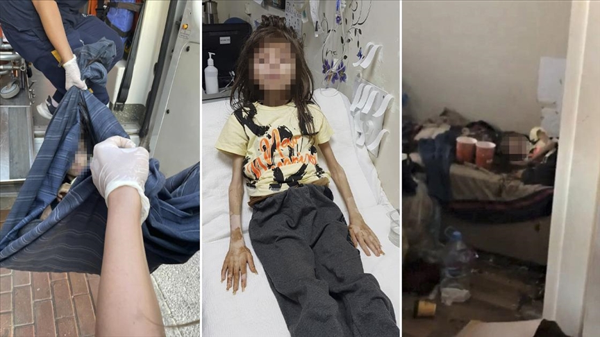 Aile ve Sosyal Hizmetler Bakanlığı'ndan Bursa'da çöp evde bulunan çocukla ilgili açıklama