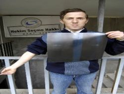 Kolundaki Saçmaları Parasızlıktan Çıkarttıramıyor