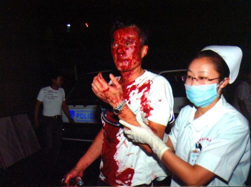 Urumçi'de bugünkü çatışmalarda en az 1 kişi yaralandı