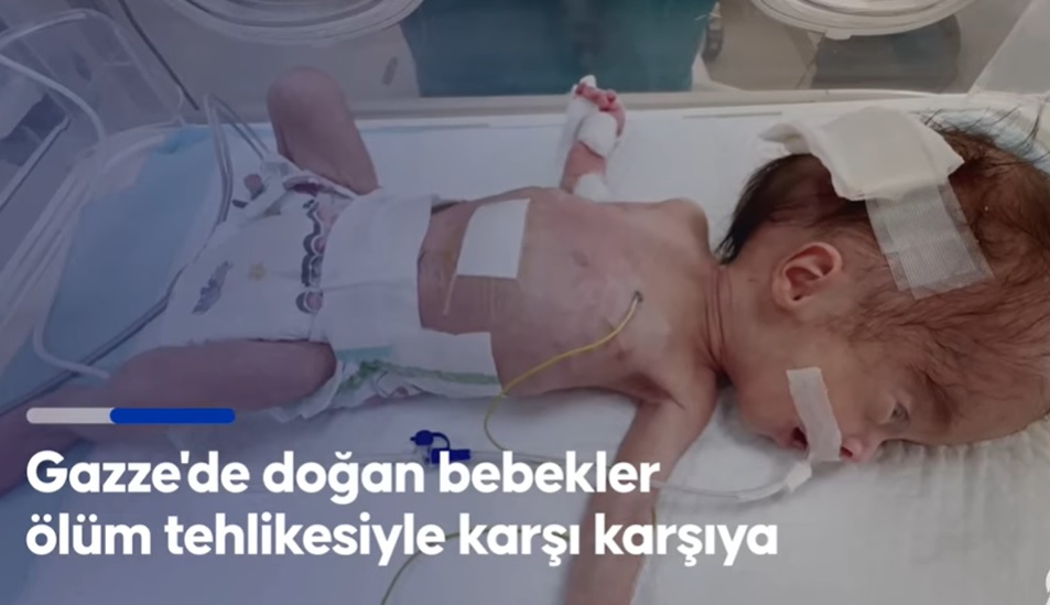 Gazze'de yeni doğan bebekler yetersiz beslenme nedeniyle ölüm tehlikesiyle karşı karşıya