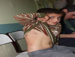 Magandalar Sokakta Oynayan 7 Yaşındaki Çocuğu Kurşunla Yaraladı