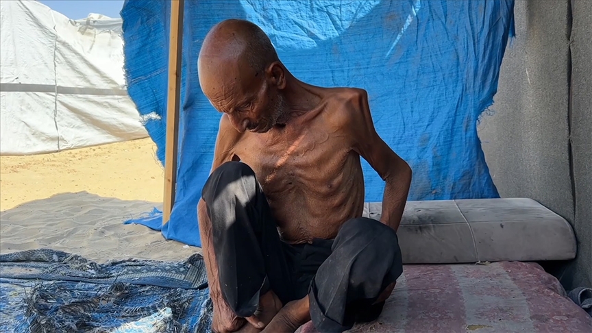 GAZZE ŞERİDİ'NDE 75 YAŞINDAKİ YAŞLI ADAM, İSRAİL'İN DAYATTIĞI AÇLIK NEDENİYLE 40 KİLOYA DÜŞTÜ