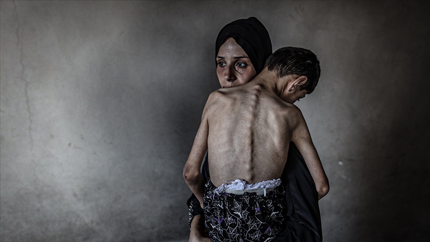 GAZZE ŞERİDİ'NDE SON 24 SAATTE 5 FİLİSTİNLİ DAHA AÇLIKTAN HAYATINI KAYBETTİ