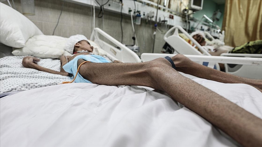 Gazze Şeridi'nde açlıktan hayatını kaybedenlerin sayısı son 24 saatte 6 artarak 140’ı çocuk, 399’a yükseldi