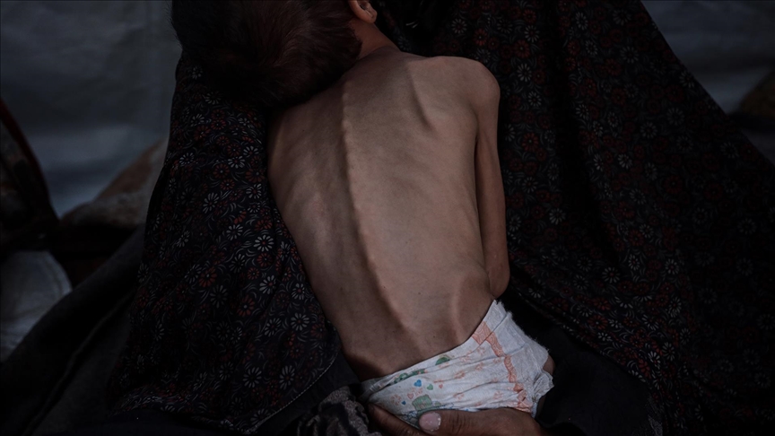 İSRAİL'İN ABLUKASI NEDENİYLE KITLIK YAŞANAN GAZZE’DE AÇLIKTAN ÖLENLERİN SAYISI 455’E YÜKSELDİ